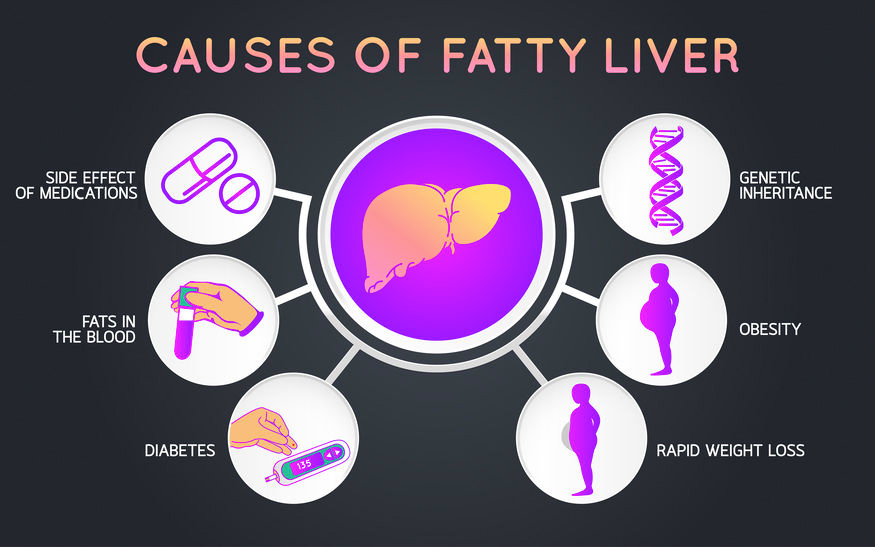 Fatty Liver Disease Treat: Top Strategies for Recovery