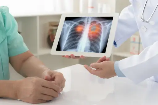 肺癌诊断
