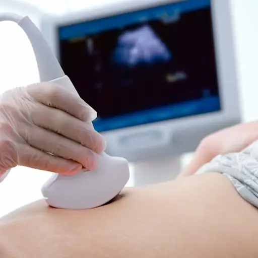 Woman in early stages of pregnancy getting ultrasound
