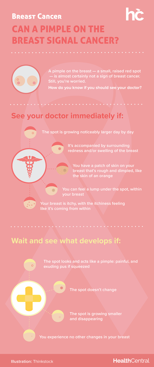Pimples on the breast inforgraphic