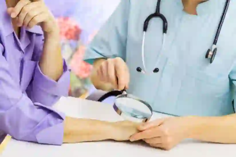 患有牛皮癣时去看皮肤科医生的10个原因