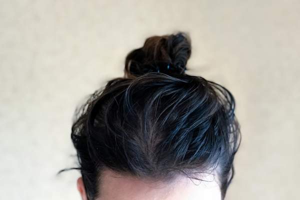 女人的头顶