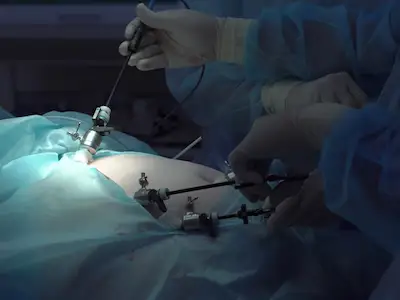 使用腹腔镜设备进行手术。