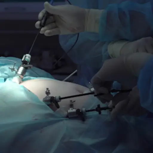 使用腹腔镜设备进行手术。