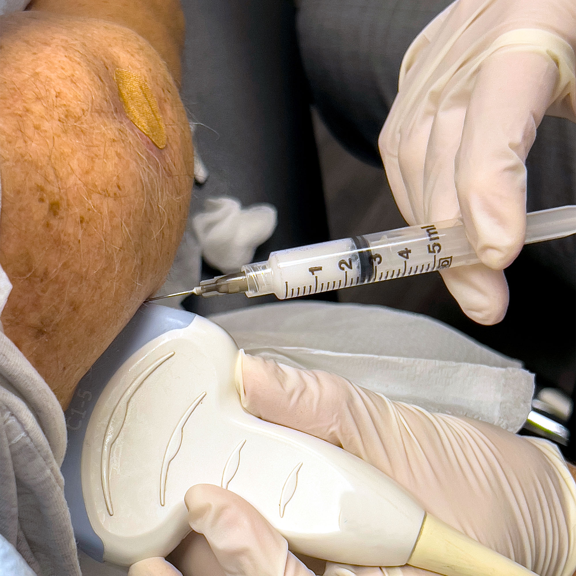 超声波的特写镜头被用来将镜头放在肩膀上