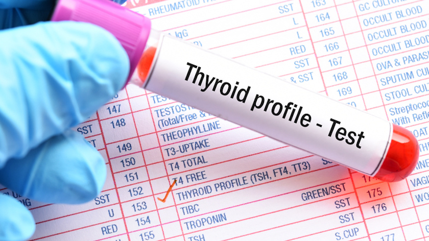 What Thyroid Levels Should Be Tested