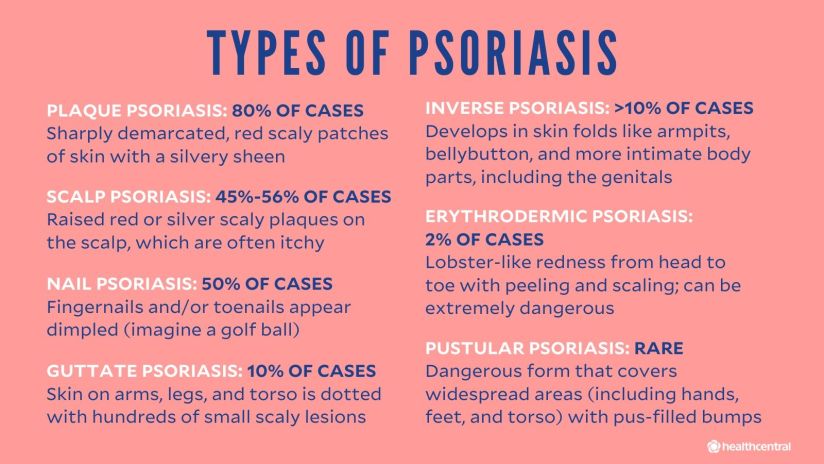Psoriasis Symptoms Causes Treatments And More