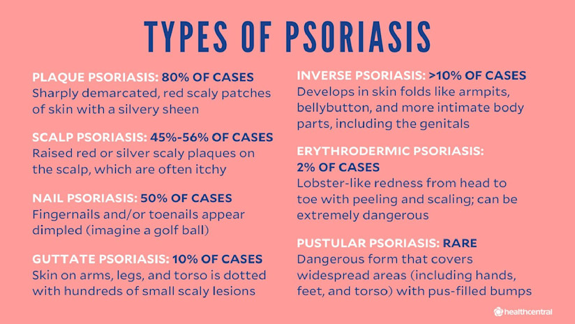 plaque psoriasis causes symptoms and treatment