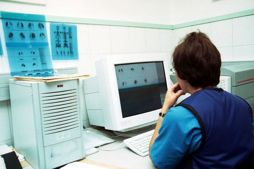 SPECT Scan