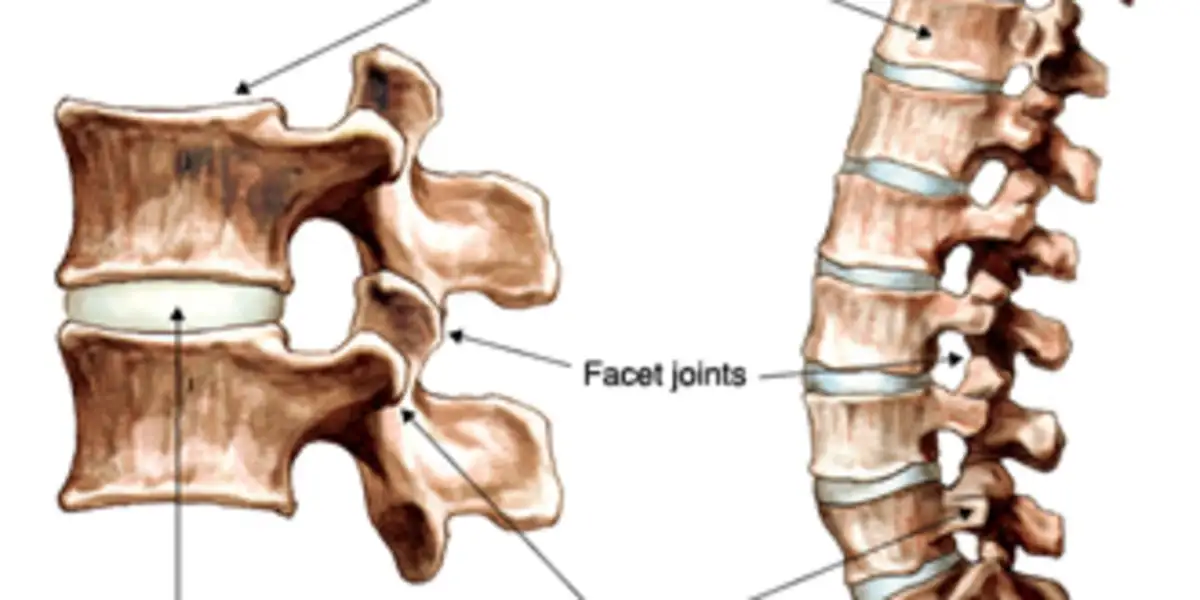Que Es Columna Degenerativa Que Es Columna Degenerativa