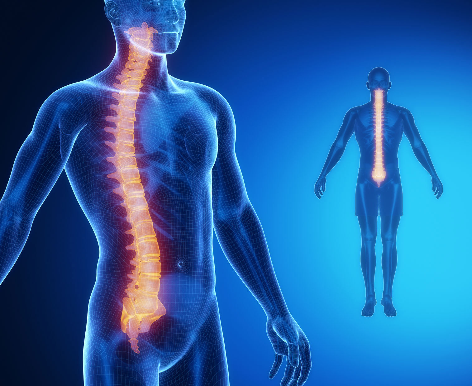 Spinal Cord Stimulation : University Pain and Spine Center