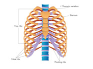 Back Pain And Slipped Rib