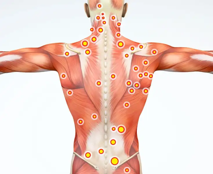 Do you have a lot of tension in your nexk and upper back? Check out th