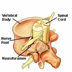 Knowing the Different Types of Spinal Stenosis and overview of Lumbar  stenosis