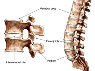 What is Lumbar Spine Degenerative Disc Disease & How to Manage? - Upswing  Health
