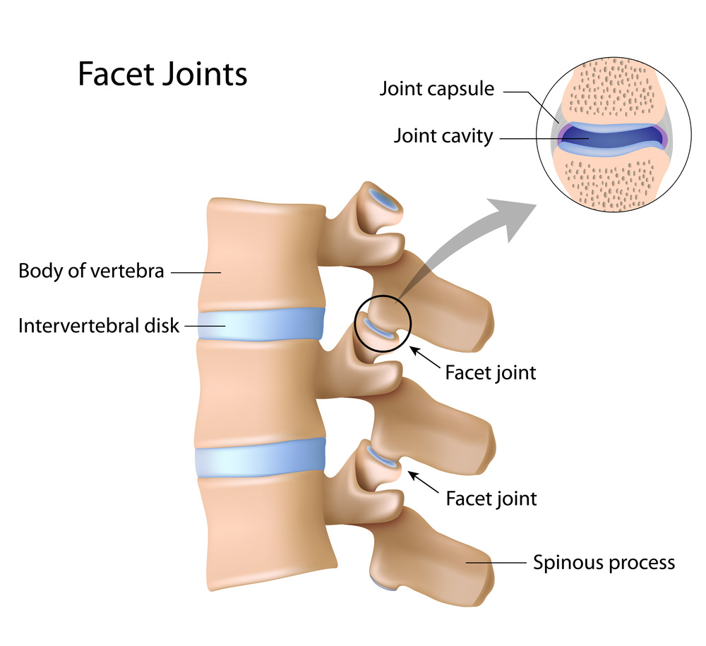 spinous process fracture