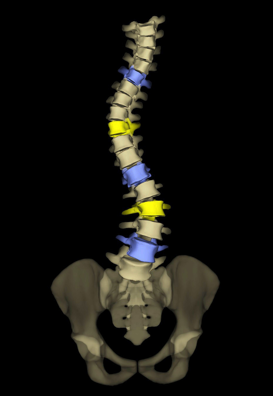 Scoliosis and Imaging
