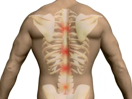 Thoracic spine syndrome  causes, symptome & treatment