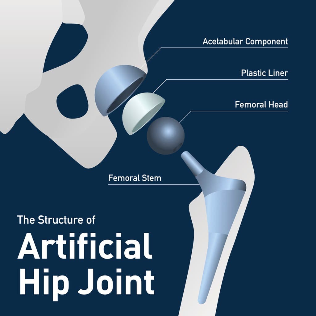 The Hip bone's connected to the back bone