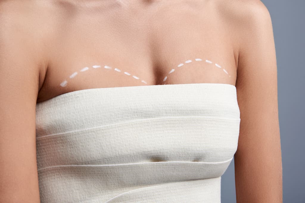 Breasts and Your Back: Why Breast Size Can Affect Back Pain