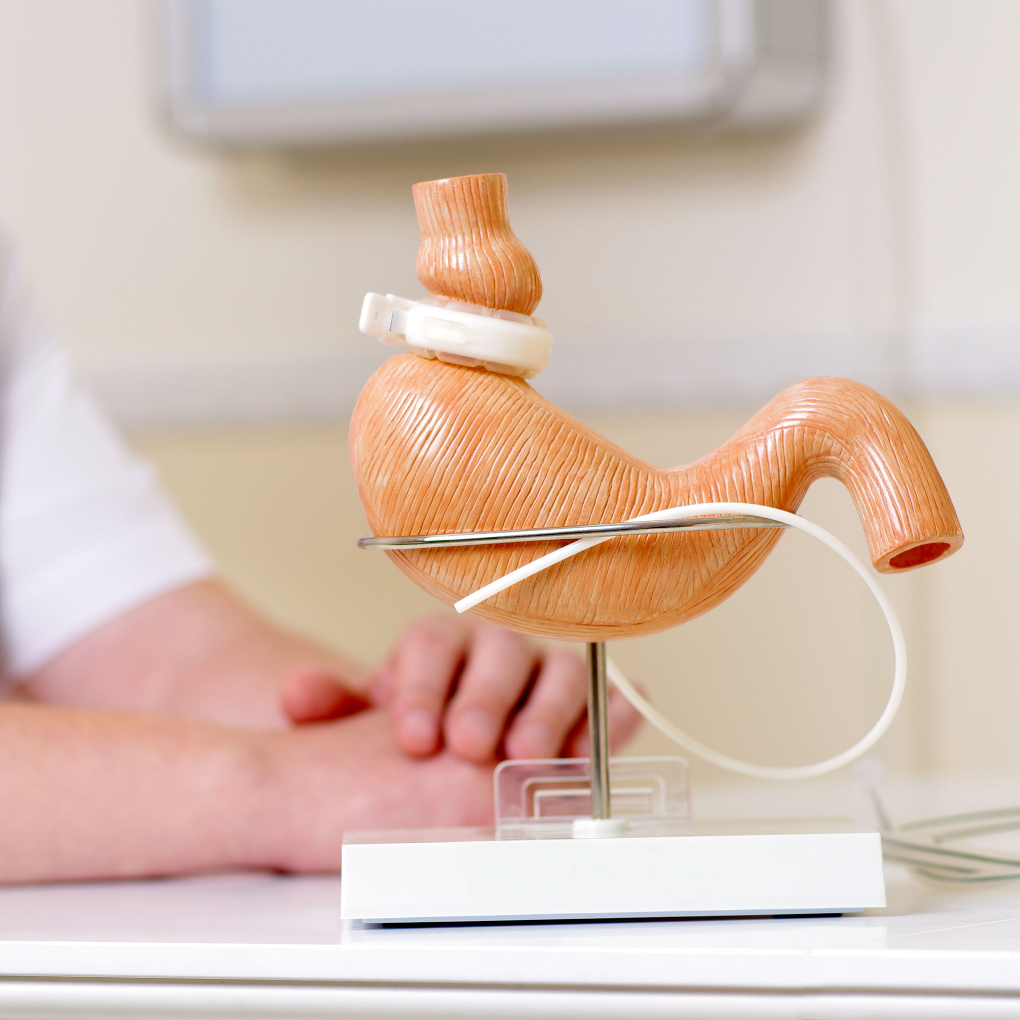 胃模型上的束带