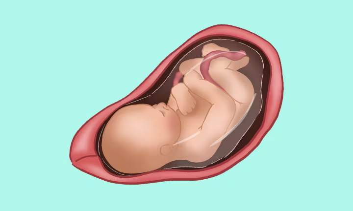 Lage des Babys in der 36. SSW