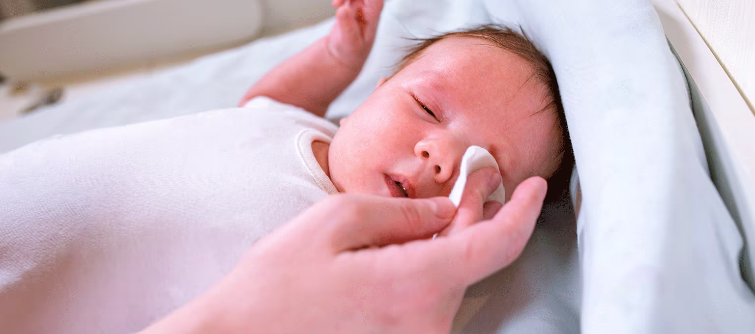 Bindvliesontsteking (conjunctivitis) bij baby’s: de oorzaak en behandeling