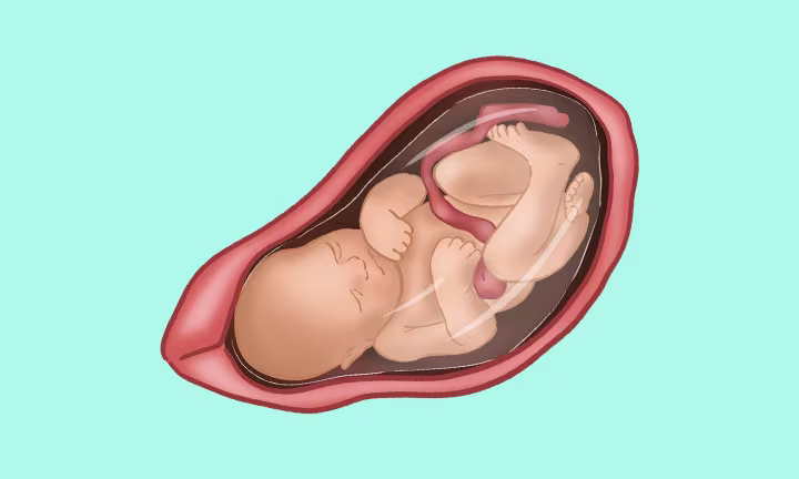 Lage des Babys in der 35. SSW