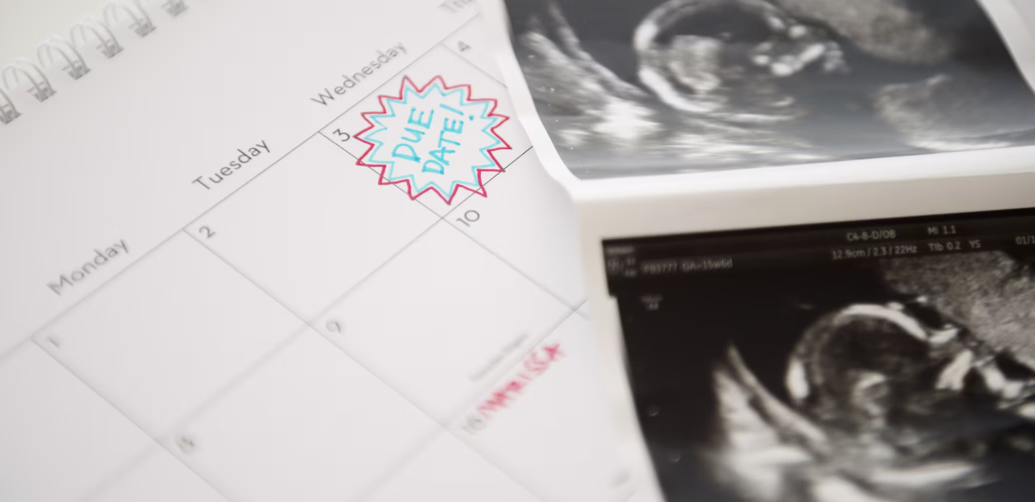 D-birth-plan-for-baby-delivery-dont-forget-to-pack--pregnancy-giving-birth
