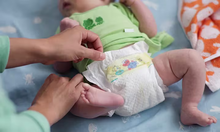 Baby wird die Windel gewechselt