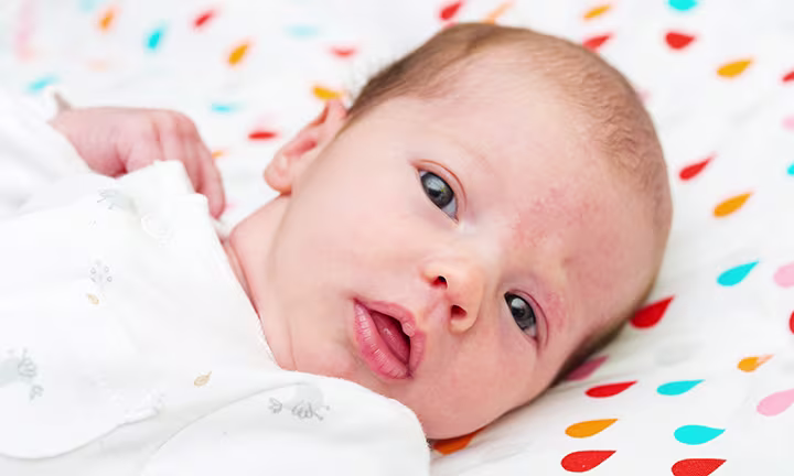 Close-up of a newborn baby lying on a patterned blanket, showing a faint red stork bite mark on the forehead near the hairline.