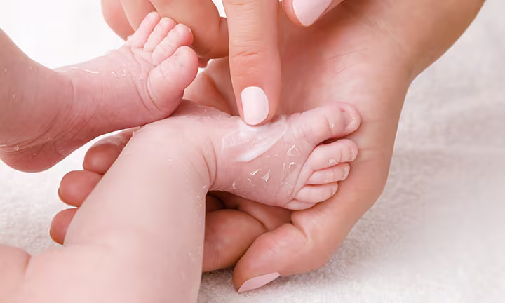 Image showing an infant's feet with peeling skin