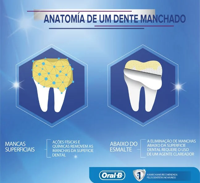 Como funciona o clareamento dental?