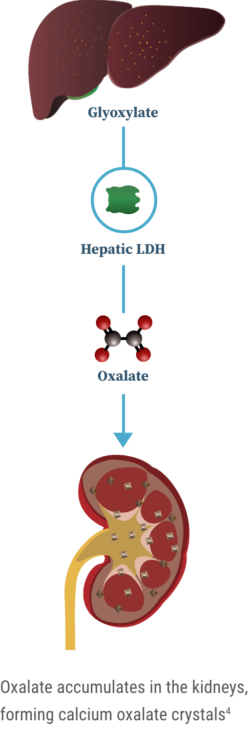 Graphic showing that hepatic LDH converts glyoxylate to oxalate, which then travels from the liver to the kidneys.