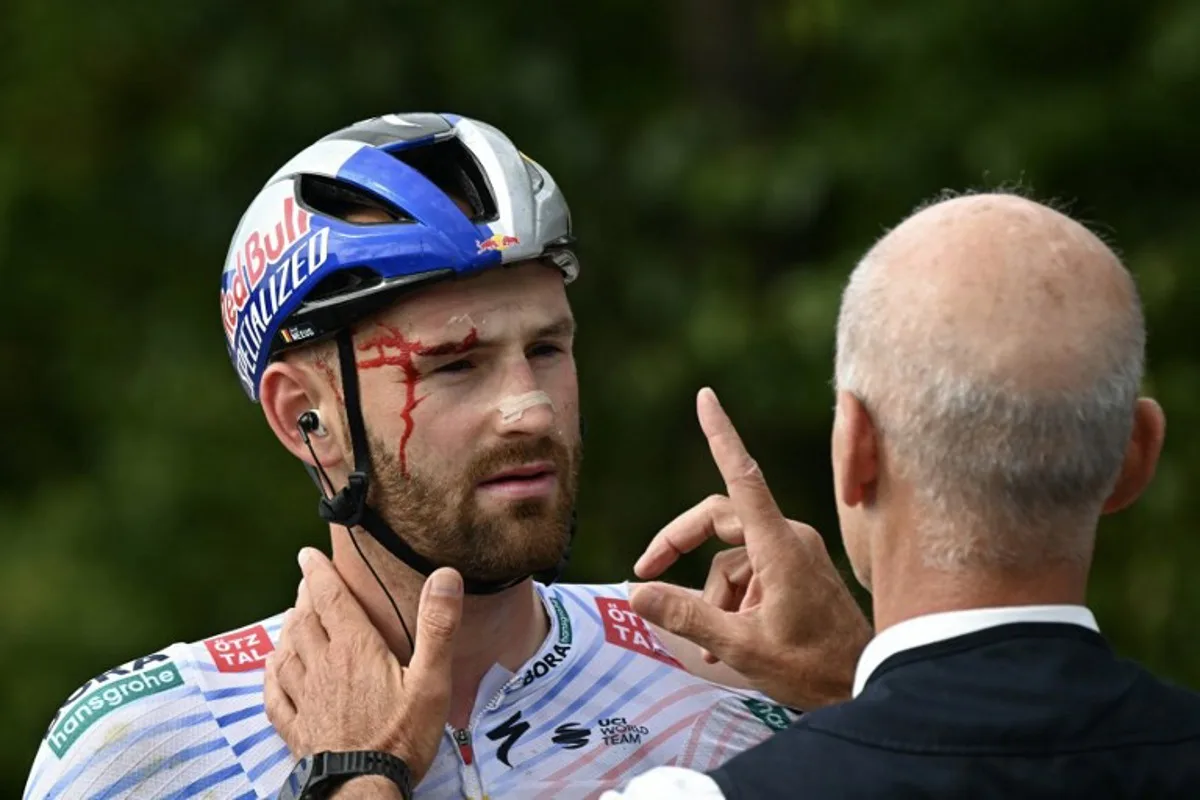 Red Bull - BORA - hansgrohe team's Belgian rider Jordi Meeus receives medical attention after suffering a crash in the final kilometres of the the 3rd stage of the 112th edition of the Tour de France cycling race, 178.3 km between Valenciennes and Dunkerque (Dunkirk), Northern France, on July 7, 2025. Loic VENANCE / AFP