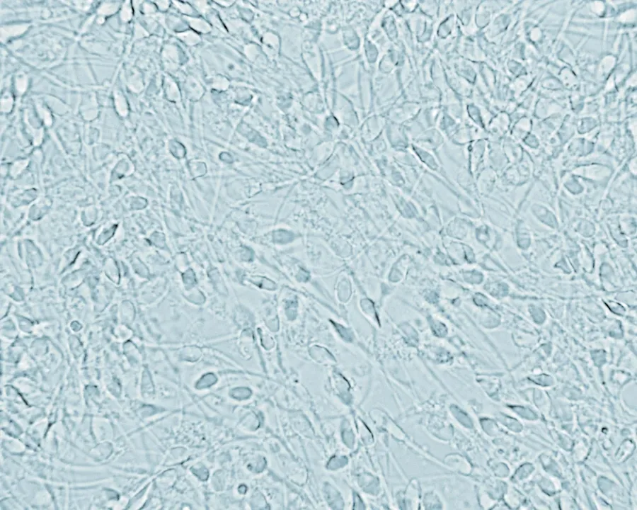 A view of sperm through a microscope. 