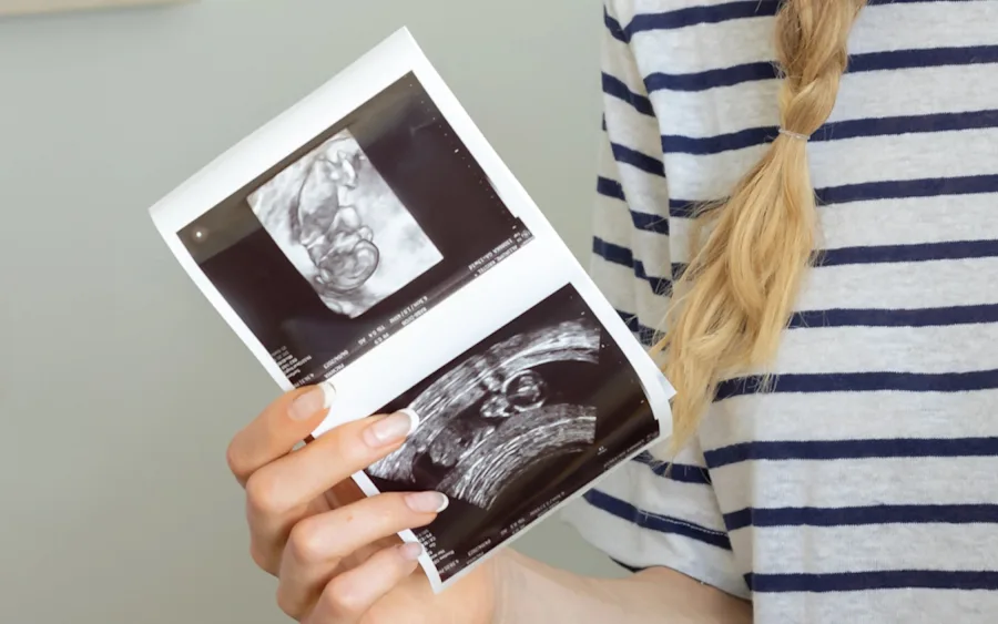 Woman holding a sonogram.