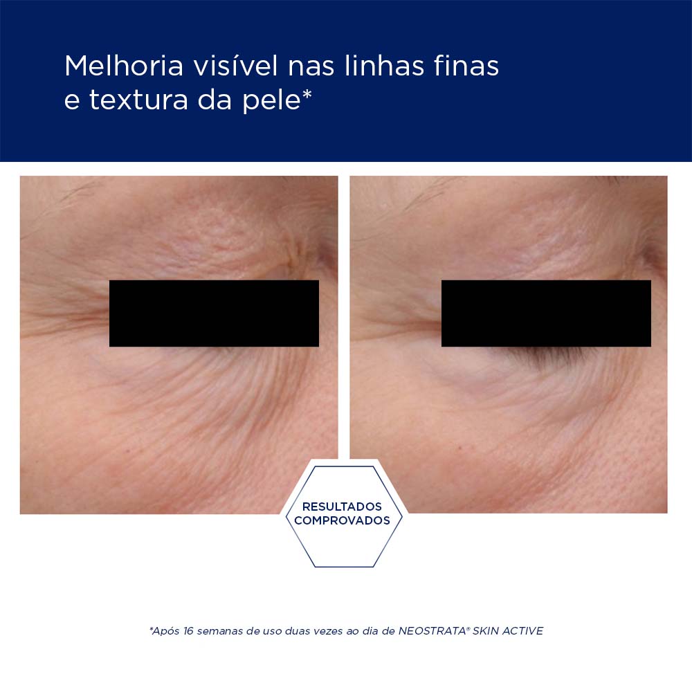 NEOSTRATA® SKIN ACTIVE INTENSIVE EYE THERAPY image 6