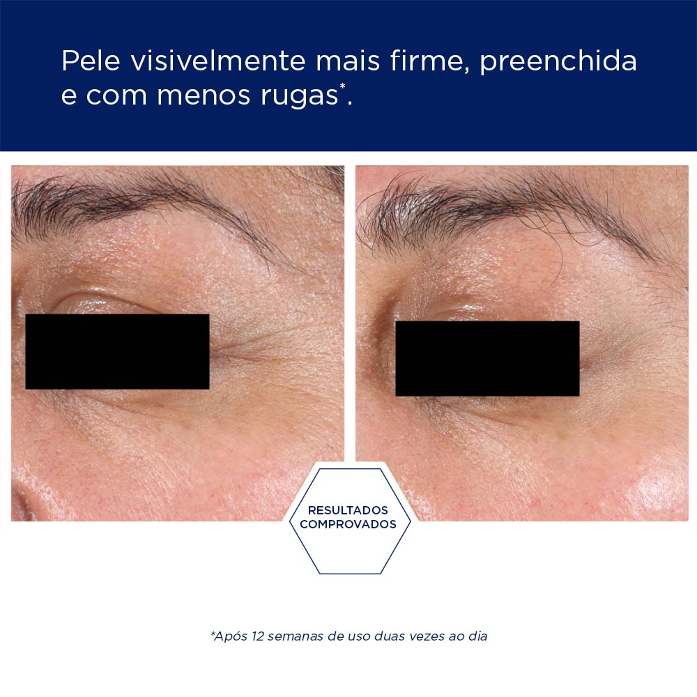 NEOSTRATA® SKIN ACTIVE TRI-THERAPY LIFTING SERUM image 6