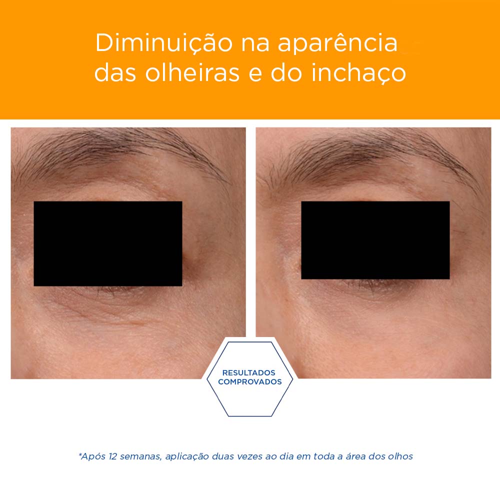 NEOSTRATA® ENLIGHTEN BRIGHTENING EYE CREAM image 6