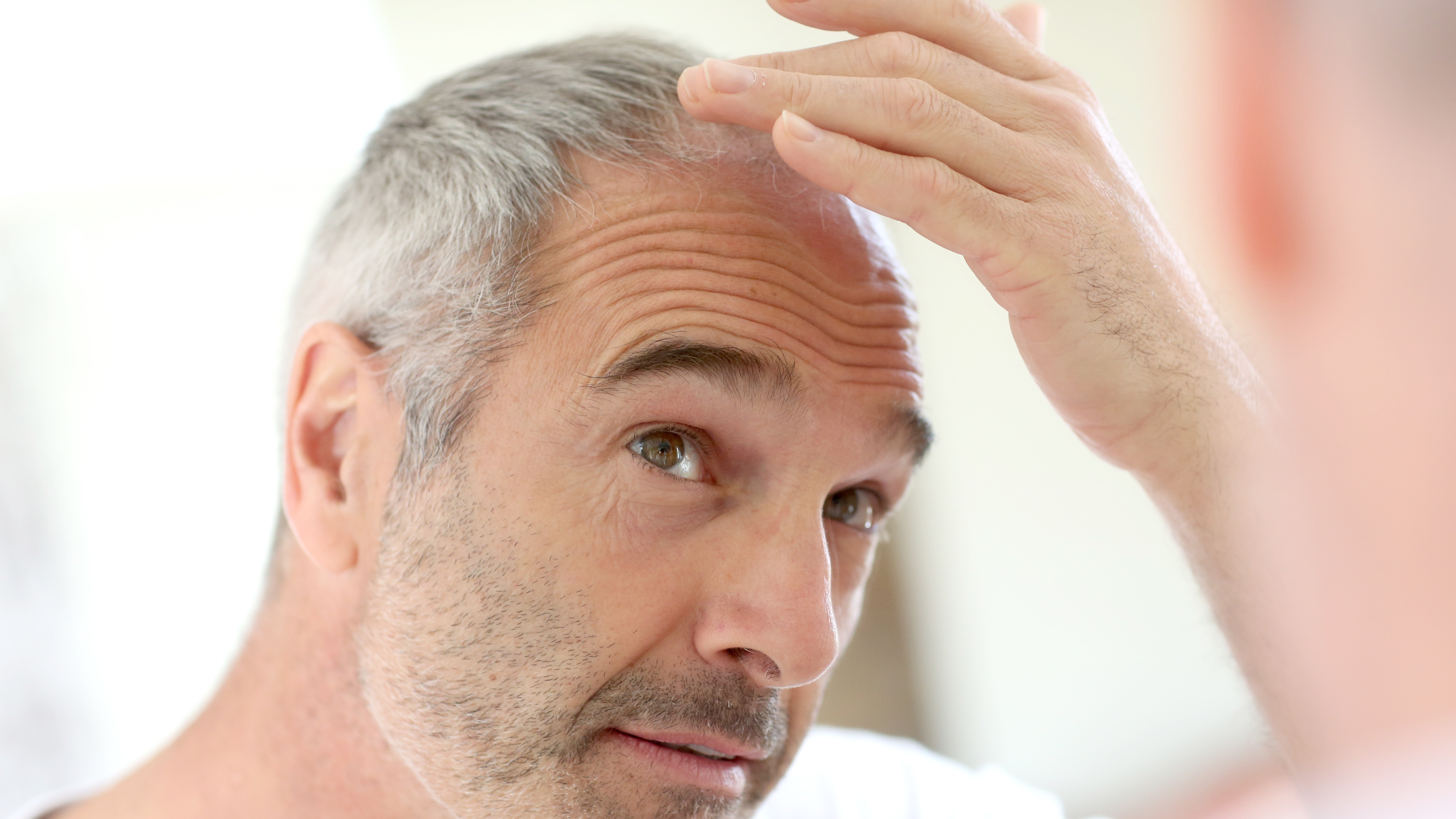 Medica Haartransplantation - Primula Hair Antalya