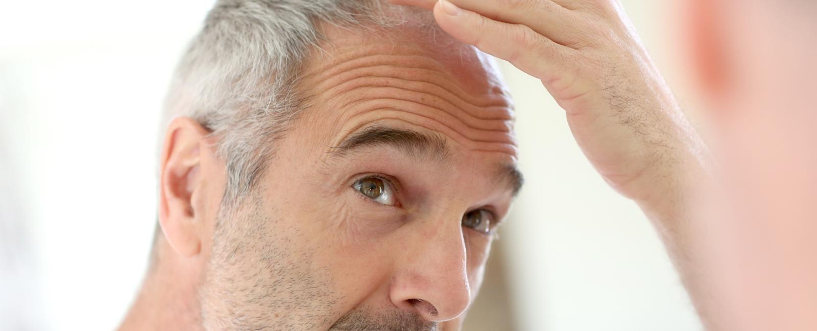 Medica Haartransplantation - Primula Hair Antalya