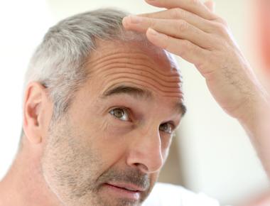 Medica Haartransplantation - Primula Hair Antalya