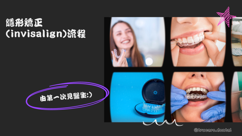 #隱形矯正 #invisalign #彤心牙科 