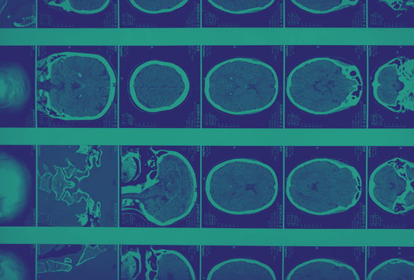 The neural architecture of consciousness