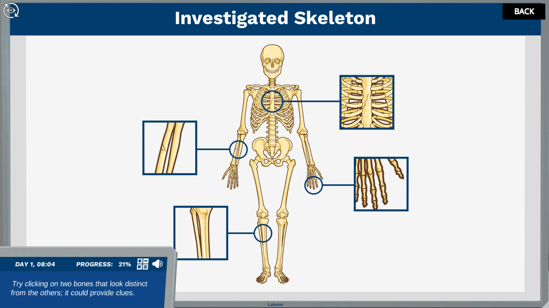 Skeletal System: Solve a Missing Person Case