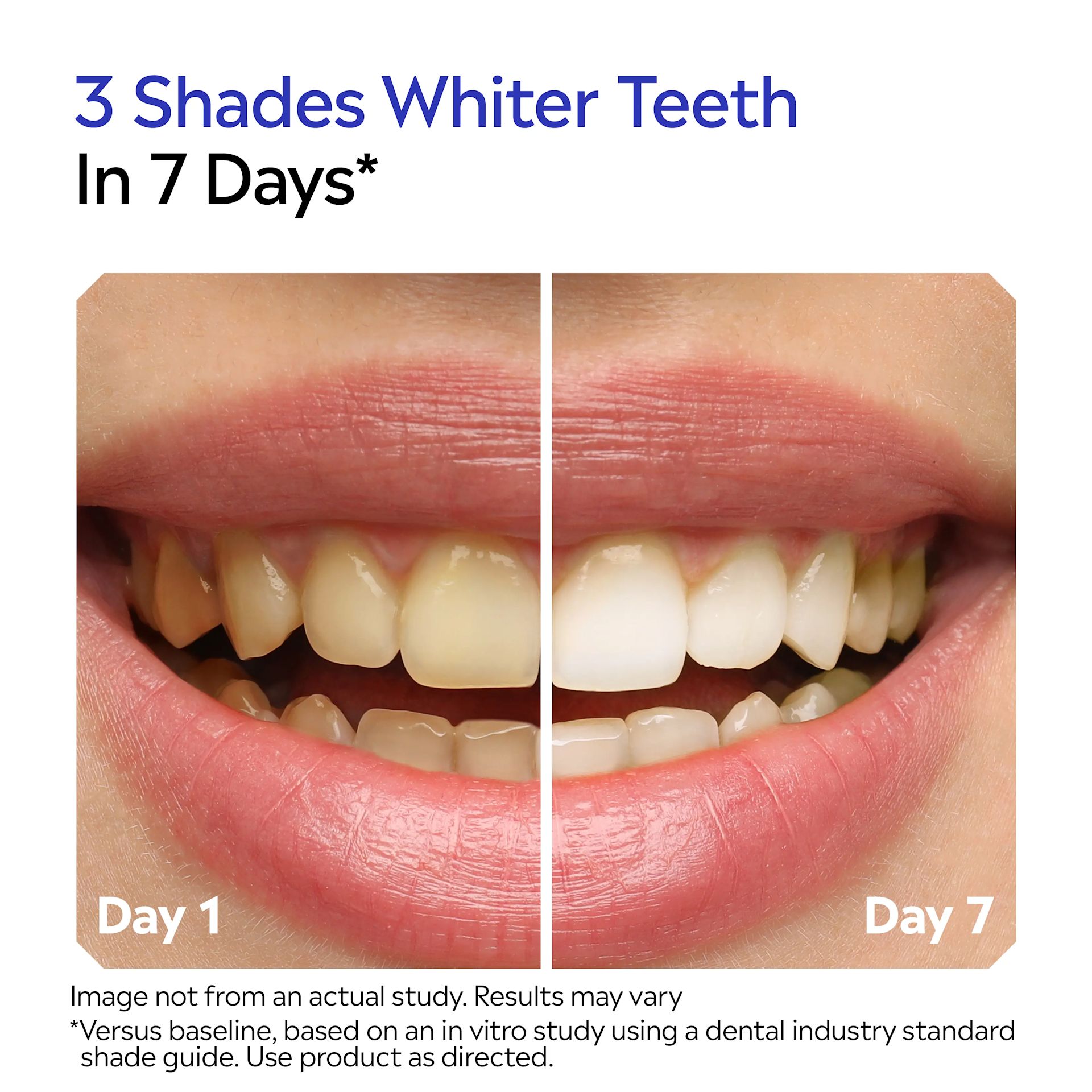 3 shades whiter teeth in 7 Days, based in vitro study standard guide