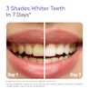 3 shades whiter teeth in 7 Days, based in vitro study standard guide