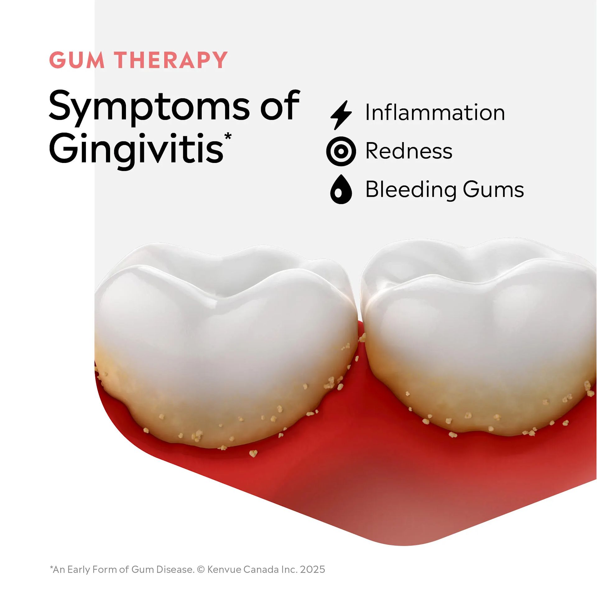 LIST ClinicalSolutions GUM ENG F3