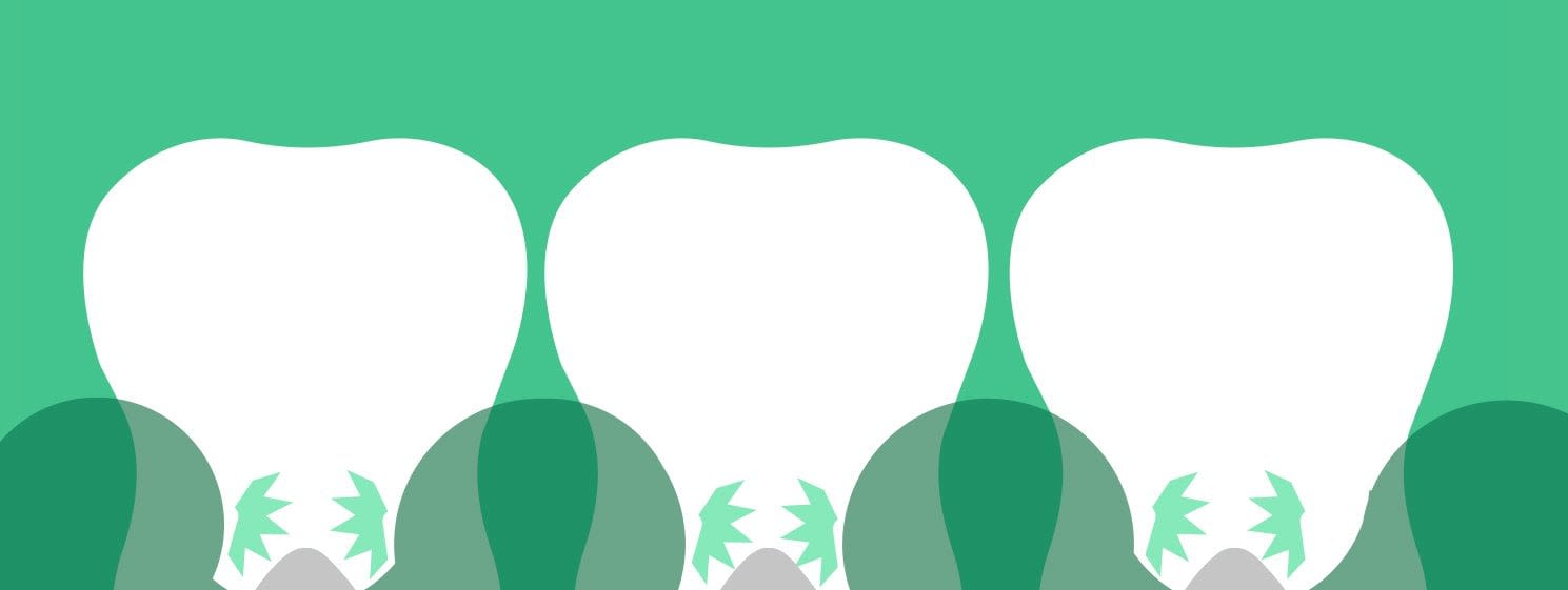 what-is-gingivitis-1.jpg